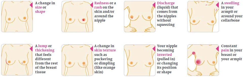 Living Magazines Breast cancer symptom checker