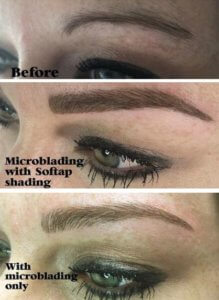Eyebrow treatments